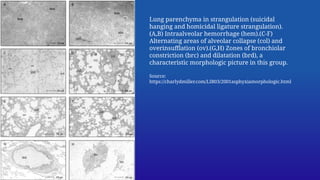 Pathology of mechanical asphyxia - a brief overview | PPTX