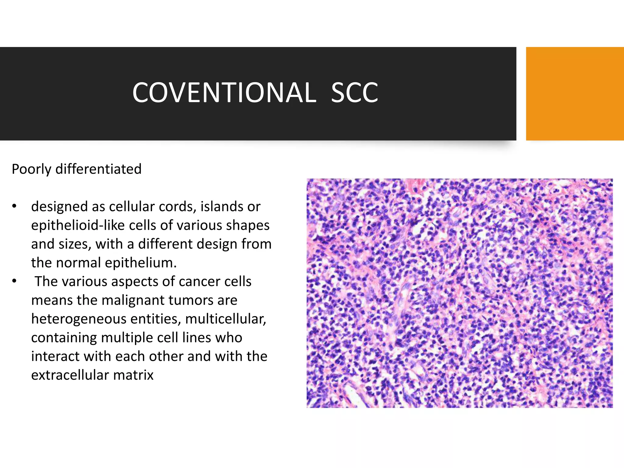 Pathology of oral cancer | PPTX