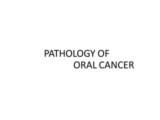 PATHOLOGY OF
ORAL CANCER
 