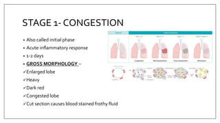 Frothy Stage PATHOLOGY OF PENUMONIA.pptx