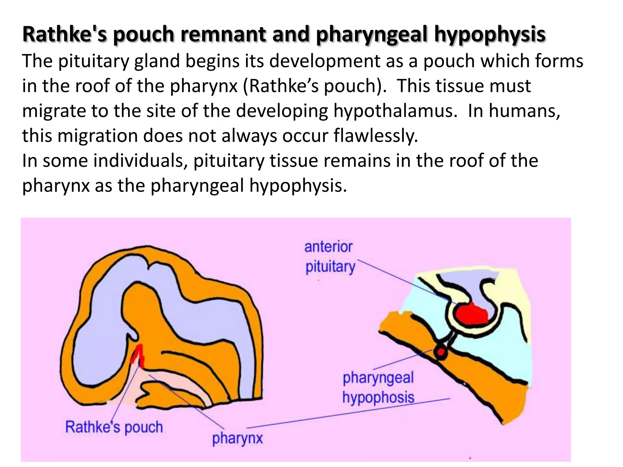Pathology of pharynx | PPTX