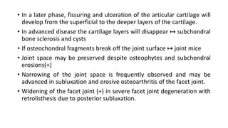 • In a later phase, fissuring and ulceration of the articular cartilage will
develop from the superficial to the deeper layers of the cartilage.
• In advanced disease the cartilage layers will disappear ↦ subchondral
bone sclerosis and cysts
• If osteochondral fragments break off the joint surface ↦ joint mice
• Joint space may be preserved despite osteophytes and subchondral
erosions(+)
• Narrowing of the joint space is frequently observed and may be
advanced in subluxation and erosive osteoarthritis of the facet joint.
• Widening of the facet joint (+) in severe facet joint degeneration with
retrolisthesis due to posterior subluxation.
 
