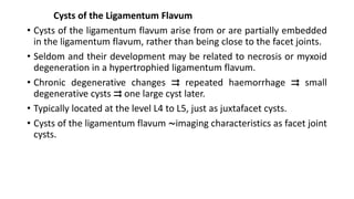 Cysts of the Ligamentum Flavum
• Cysts of the ligamentum flavum arise from or are partially embedded
in the ligamentum flavum, rather than being close to the facet joints.
• Seldom and their development may be related to necrosis or myxoid
degeneration in a hypertrophied ligamentum flavum.
• Chronic degenerative changes ⇉ repeated haemorrhage ⇉ small
degenerative cysts ⇉ one large cyst later.
• Typically located at the level L4 to L5, just as juxtafacet cysts.
• Cysts of the ligamentum flavum ∼imaging characteristics as facet joint
cysts.
 