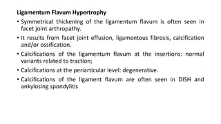 Ligamentum Flavum Hypertrophy
• Symmetrical thickening of the ligamentum flavum is often seen in
facet joint arthropathy.
• It results from facet joint effusion, ligamentous fibrosis, calcification
and/or ossification.
• Calcifications of the ligamentum flavum at the insertions: normal
variants related to traction;
• Calcifications at the periarticular level: degenerative.
• Calcifications of the ligament flavum are often seen in DISH and
ankylosing spondylitis
 
