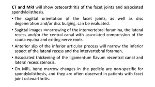 CT and MRI will show osteoarthritis of the facet joints and associated
spondylolisthesis.
• The sagittal orientation of the facet joints, as well as disc
degeneration and/or disc bulging, can be evaluated.
• Sagittal images ⇒narrowing of the intervertebral foramina, the lateral
recess and/or the central canal with associated compression of the
cauda equina and exiting nerve roots.
• Anterior slip of the inferior articular process will narrow the inferior
aspect of the lateral recess and the intervertebral foramen.
• Associated thickening of the ligamentum flavum ⇒central canal and
lateral recess stenosis.
• On MRI, bone marrow changes in the pedicle are non-specific for
spondylolisthesis, and they are often observed in patients with facet
joint osteoarthritis.
 