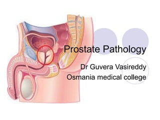 Prostate Pathology
Dr Guvera Vasireddy
Osmania medical college
 