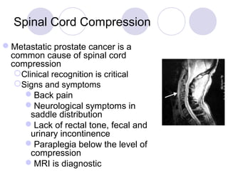 Prostate Compression Pathology of prostate | PPT