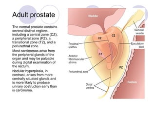 Adult prostate
The normal prostate contains
several distinct regions,
including a central zone (CZ),
a peripheral zone (PZ...