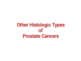 Other Histologic Types
of
Prostate Cancers
 