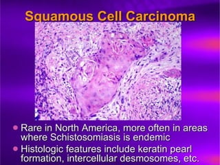 Prostate Pathophysiology23.ppt prostate cancer prostatic hyperplasia