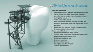 Clinical features & causes
Signs and symptoms
 Severe pain within a few days after a tooth extraction
 Partial or total ...