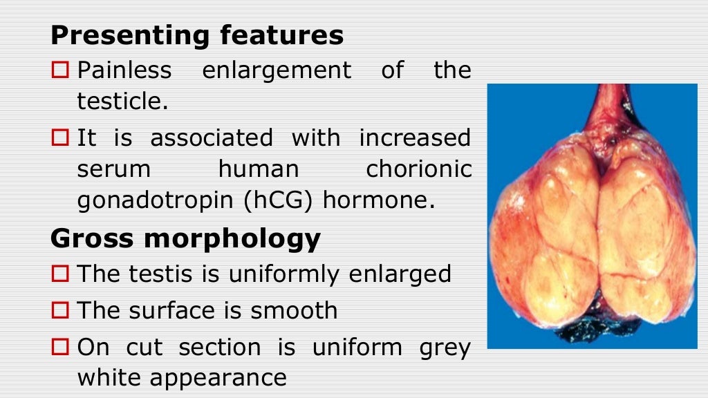 Pathology of the male reproductive system 2