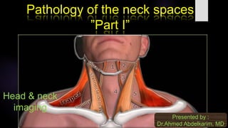 Pathology of the neck spaces
”Part I”
Presented by :
Dr.Ahmed Abdelkarim, MD
Head & neck
imaging
 