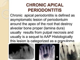 Pathologyoftheperiapex 130320105442-phpapp02 | PPTX