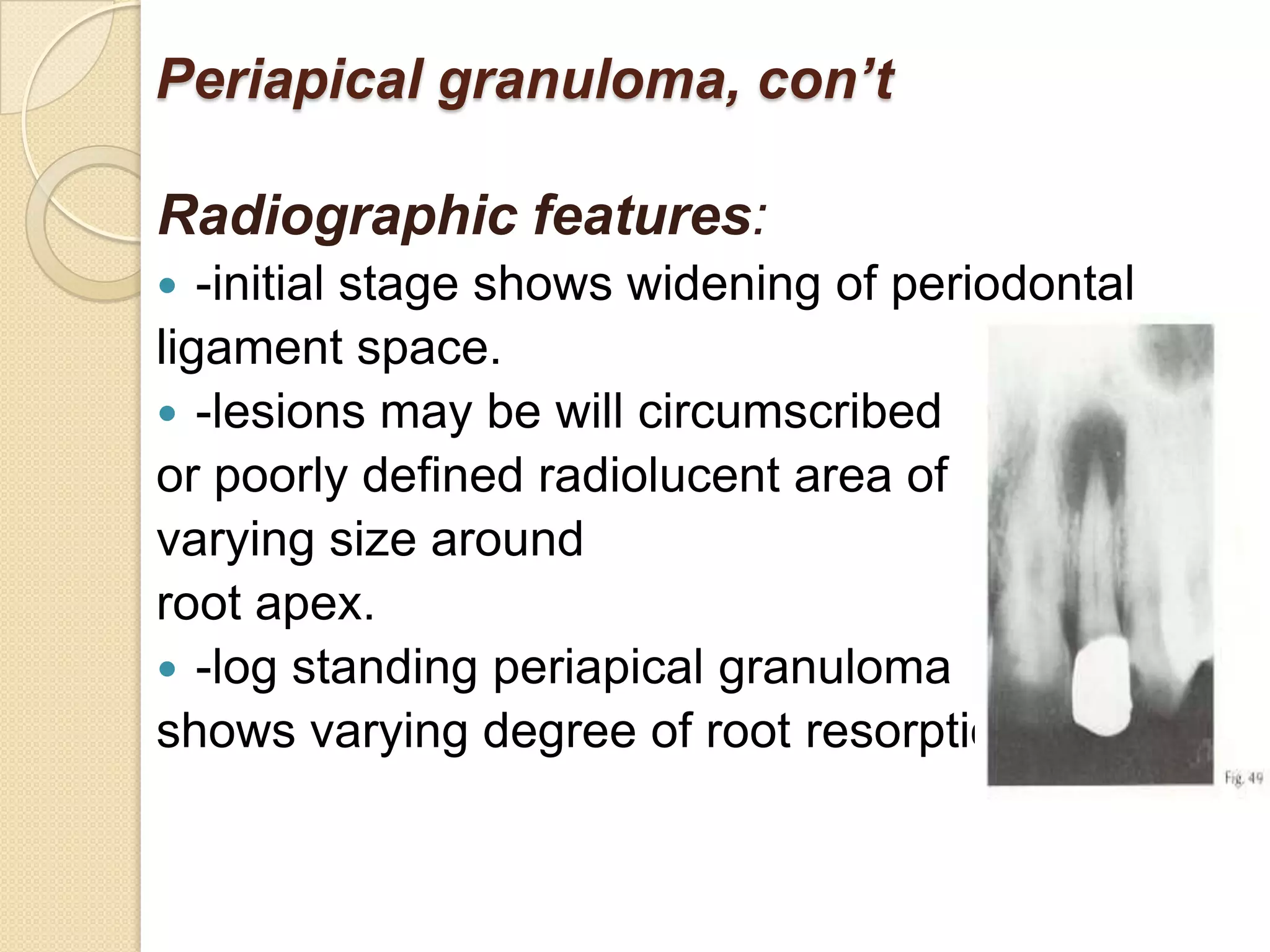 Periapical granuloma, con’t

Radiographic features:
  -initial stage shows widening of periodontal
ligament space.
 -lesions may be will circumscribed
or poorly defined radiolucent area of
varying size around
root apex.
 -log standing periapical granuloma
shows varying degree of root resorption.
 