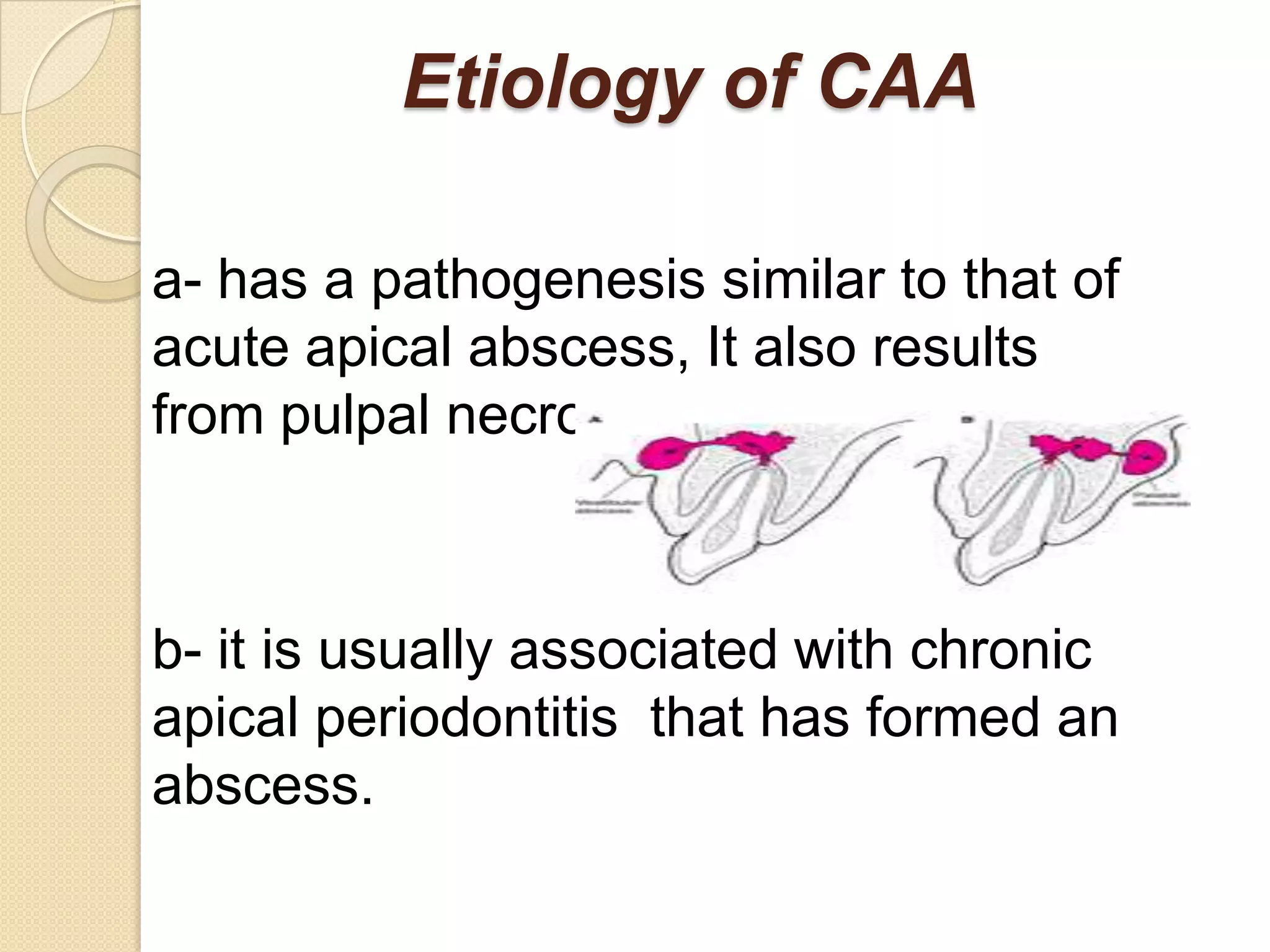 Etiology of CAA

a- has a pathogenesis similar to that of
acute apical abscess, It also results
from pulpal necrosis.



b- it is usually associated with chronic
apical periodontitis that has formed an
abscess.
 