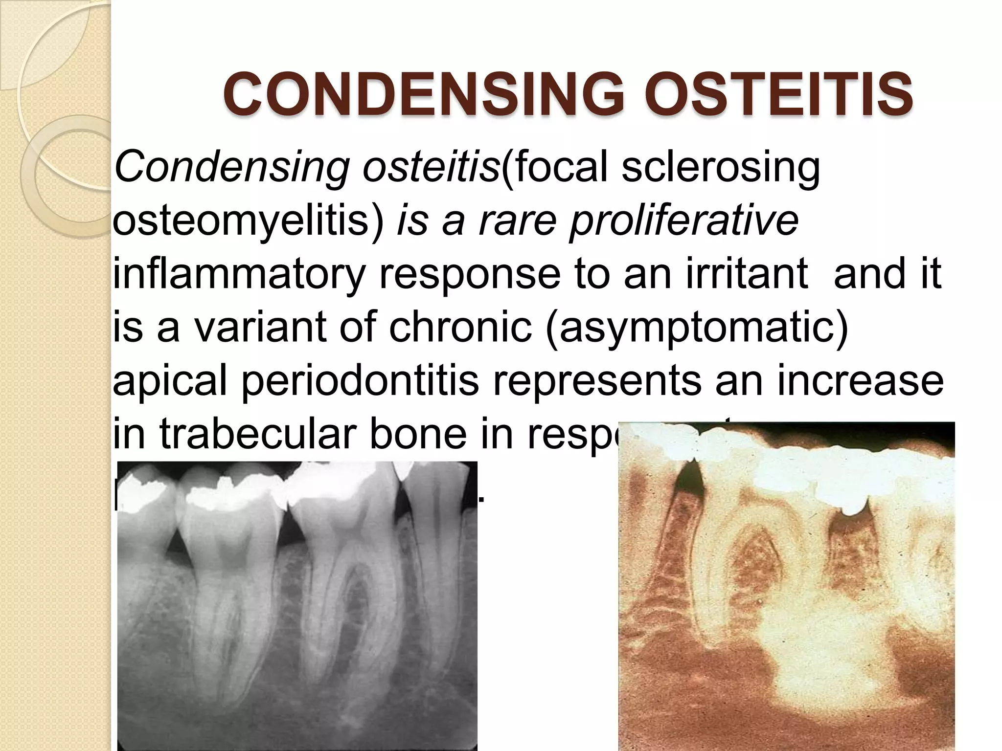 CONDENSING OSTEITIS
Condensing osteitis(focal sclerosing
osteomyelitis) is a rare proliferative
inflammatory response to an irritant and it
is a variant of chronic (asymptomatic)
apical periodontitis represents an increase
in trabecular bone in response to
persistent irritation.
 