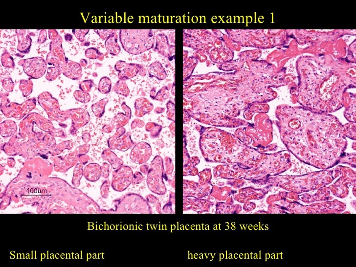 Pathology of the_placenta__lecture
