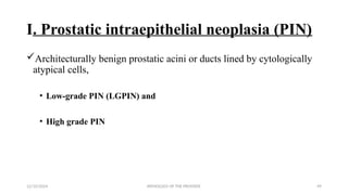 Pathology_of_the_Prostate[1].pptx and prostate ca | PPTX