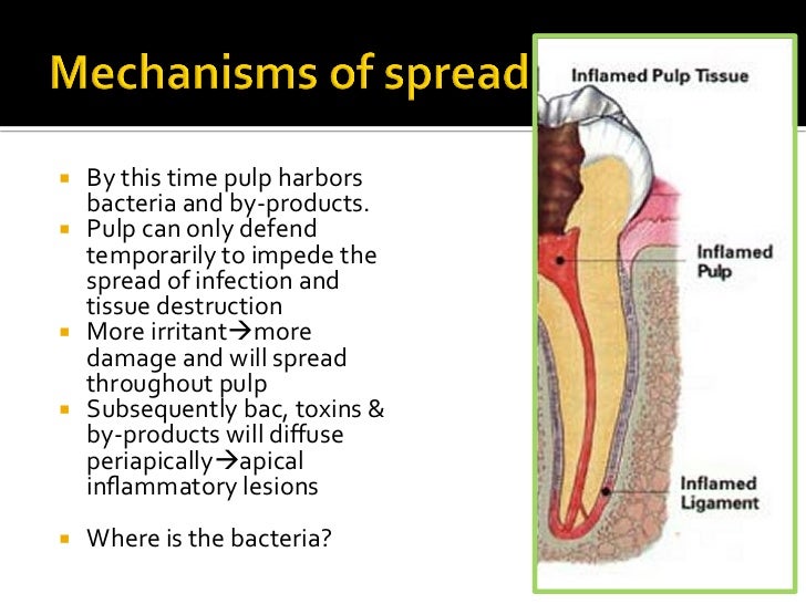 Pathology of the pulpal and periradicular tissues 2012 2013