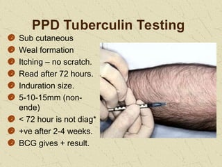 Pathology of Tuberculosis12345567778.ppt