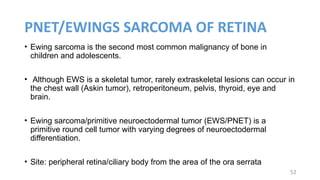 Pnet Sarcoma Pathology of tumors of retina - sathyashree k v.pptx