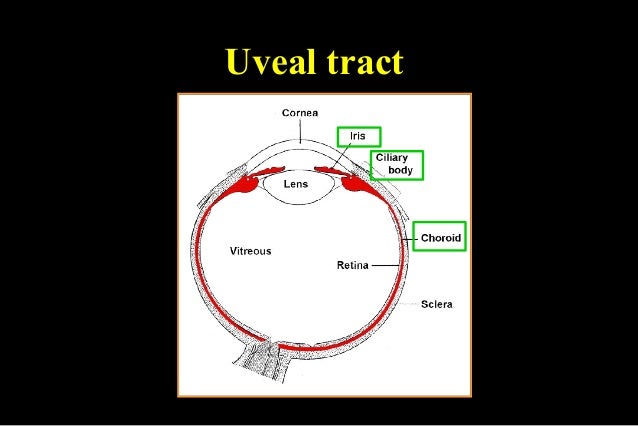 uveal tract