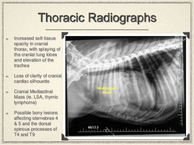 mediastinal lymphosarcoma