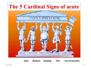 Heat Redness Swelling Pain Loss of function
The 5 Cardinal Signs of acute
115
2/21/2023
 