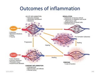 Outcomes of inflammation
140
2/21/2023
 
