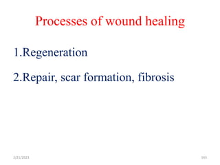Processes of wound healing
1.Regeneration
2.Repair, scar formation, fibrosis
143
2/21/2023
 