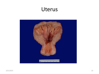 Uterus
2/21/2023 23
 