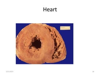 Heart
2/21/2023 28
 