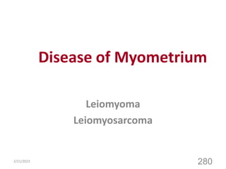 Disease of Myometrium
Leiomyoma
Leiomyosarcoma
2/21/2023
280
 