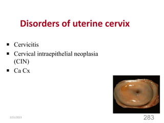 Disorders of uterine cervix
Cervicitis
Cervical intraepithelial neoplasia
(CIN)
Ca Cx
2/21/2023
283
 