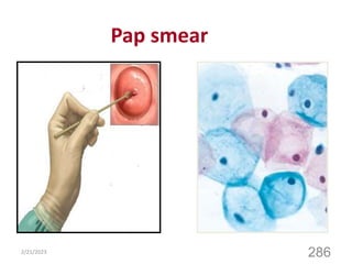 Pap smear
2/21/2023
286
 