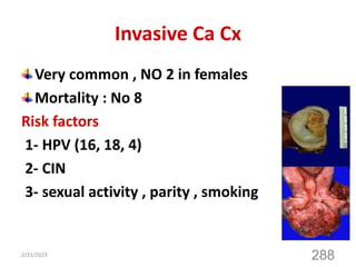 Invasive Ca Cx
Very common , NO 2 in females
Mortality : No 8
Risk factors
1- HPV (16, 18, 4)
2- CIN
3- sexual activity , parity , smoking
2/21/2023
288
 