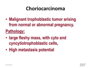 Choriocarcinoma
• Malignant trophoblastic tumor arising
from normal or abnormal pregnancy.
Pathology:
• large fleshy mass, with cyto and
cyncytiotrophoblastic cells,
• High metastasis potential
2/21/2023
297
 
