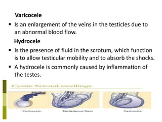 Varicocele
 Is an enlargement of the veins in the testicles due to
an abnormal blood flow.
Hydrocele
 Is the presence of fluid in the scrotum, which function
is to allow testicular mobility and to absorb the shocks.
 A hydrocele is commonly caused by inflammation of
the testes.
 