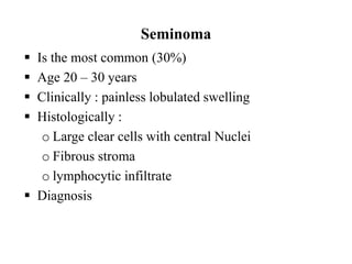 Seminoma
 Is the most common (30%)
 Age 20 – 30 years
 Clinically : painless lobulated swelling
 Histologically :
o Large clear cells with central Nuclei
o Fibrous stroma
o lymphocytic infiltrate
 Diagnosis
 