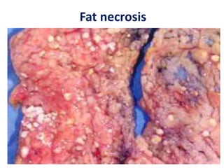 Fat necrosis
2/21/2023 69
 