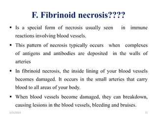 F. Fibrinoid necrosis????
 Is a special form of necrosis usually seen in immune
reactions involving blood vessels.
 This pattern of necrosis typically occurs when complexes
of antigens and antibodies are deposited in the walls of
arteries
 In fibrinoid necrosis, the inside lining of your blood vessels
becomes damaged. It occurs in the small arteries that carry
blood to all areas of your body.
 When blood vessels become damaged, they can breakdown,
causing lesions in the blood vessels, bleeding and bruises.
2/21/2023 72
 