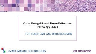 Visual Recognition of Tissue Patterns on
Pathology Slides
web-pathology.net
FOR HEALTHCARE AND DRUG DISCOVERY
SMART IMAGING TECHNOLOGIES
 