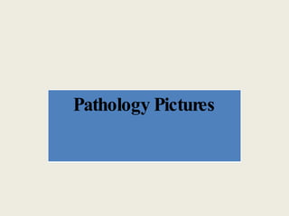 Pathology Pictures 