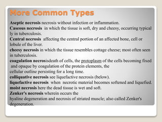 More Common Types
Aseptic necrosis necrosis without infection or inflammation.
Caseous necrosis in which the tissue is soft, dry and cheesy, occurring typical
ly in tuberculosis.
Central necrosis affecting the central portion of an affected bone, cell or
lobule of the liver.
cheesy necrosis in which the tissue resembles cottage cheese; most often seen
in tuberculosis.
coagulation necrosisdeath of cells, the protoplasm of the cells becoming fixed
and opaque by coagulation of the protein elements, the
cellular outline persisting for a long time.
colliquative necrosis see liquefactive necrosis (below).
liquefactive necrosis when necrotic material becomes softened and liquefied.
moist necrosis here the dead tissue is wet and soft.
Zenker's necrosis wherein occurs the
hyaline degeneration and necrosis of striated muscle; also called Zenker's
degeneration.
 