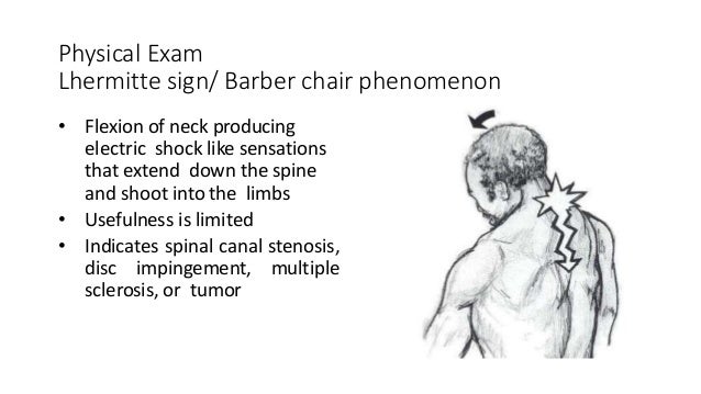 How Is Lhermitte’S Sign Test Diagnosed? – SPPI