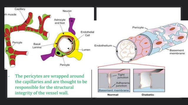 Pathophysiology of Diabetic retinopathy | PPT