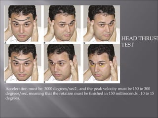 Acceleration must be 3000 degrees/sec2 , and the peak velocity must be 150 to 300
degrees/sec, meaning that the rotation must be finished in 150 milliseconds , 10 to 15
degrees.
HEAD THRUST
TEST
 