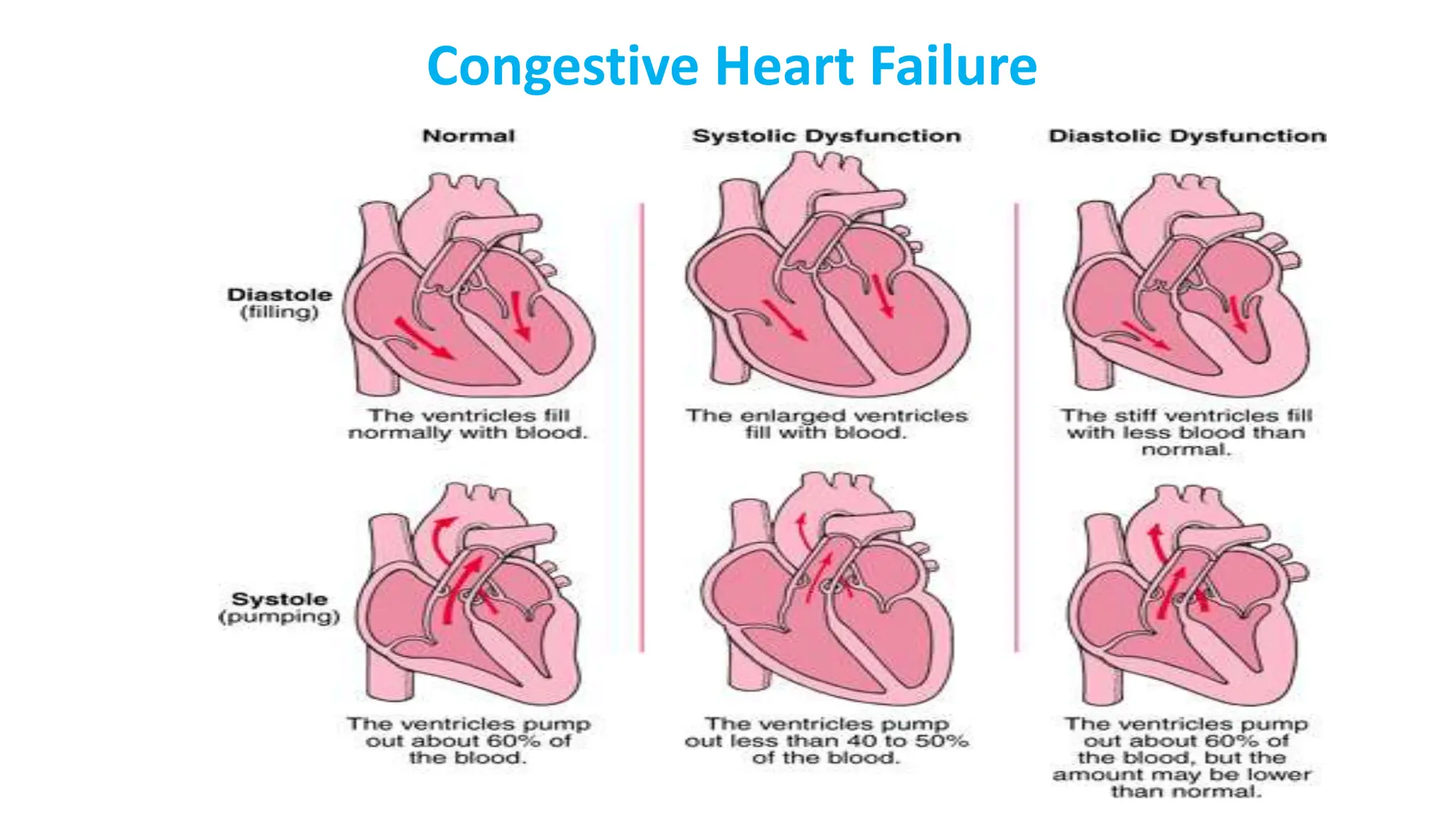 Pathophysiology of CHF12345678922222.ppt