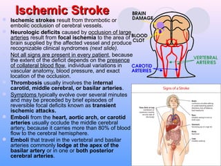 Ischemic StrokeIschemic Stroke
 Ischemic strokes result from thrombotic or
embolic occlusion of cerebral vessels.
 Neurologic deficits caused by occlusion of large
arteries result from focal ischemia to the area of
brain supplied by the affected vessel and produce
recognizable clinical syndromes (next slide).
 Not all signs are present in every patient, because
the extent of the deficit depends on the presence
of collateral blood flow, individual variations in
vascular anatomy, blood pressure, and exact
location of the occlusion.
 Thrombosis usually involves the internal
carotid, middle cerebral, or basilar arteries.
 Symptoms typically evolve over several minutes
and may be preceded by brief episodes of
reversible focal deficits known as transient
ischemic attacks.
 Emboli from the heart, aortic arch, or carotid
arteries usually occlude the middle cerebral
artery, because it carries more than 80% of blood
flow to the cerebral hemisphere.
 Emboli that travel in the vertebral and basilar
arteries commonly lodge at the apex of the
basilar artery or in one or both posterior
cerebral arteries.
 